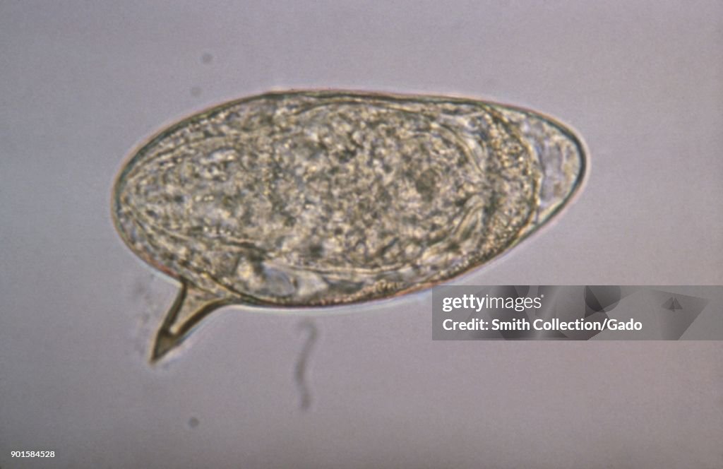 Schistosoma Mansoni Egg