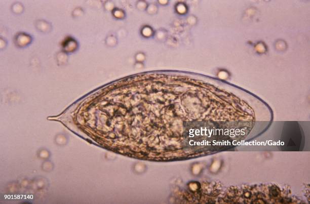 Photomicrograph of an egg from the Schistosoma haematobium trematode parasite magnified 500x, one of the blood flukes that cause the most prevalent...