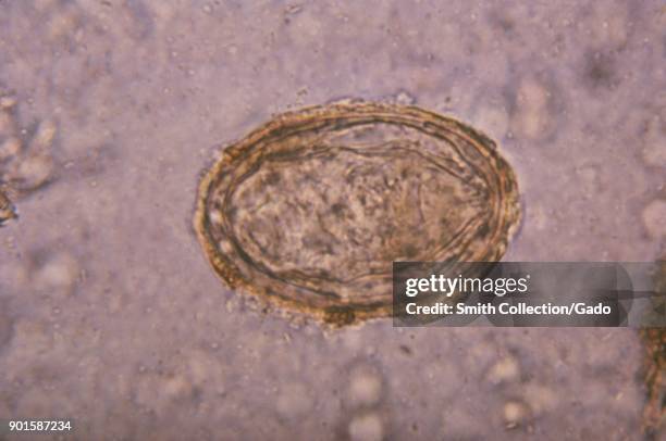Photomicrograph of an egg from the trematode Schistosoma japonicum, one of the blood flukes that cause the parasitic disease Schistosomiasis, 1979....