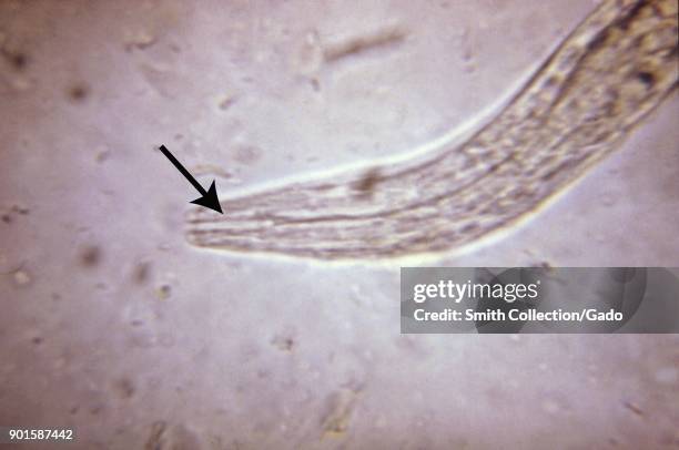 Photomicrograph showing the buccal cavity morphology of a hookworm in its rhabiditiform larval stage, 1979. Image courtesy CDC.