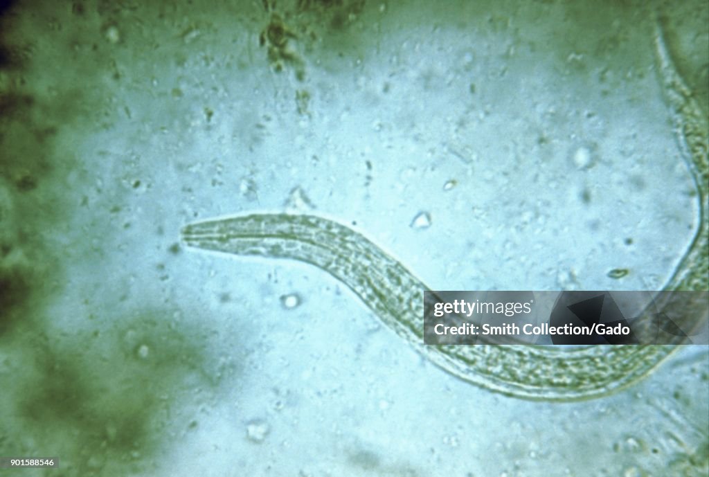 Photomicrograph of human hookworm rhabditiform larva which is its