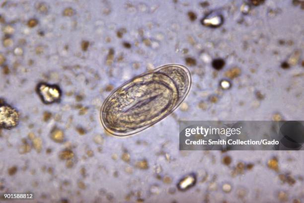Embryophore 845 Tapeworm Stock Photos, High-Res Pictures, and Images - Getty Images