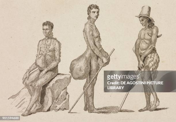Natives affected by leprosy and elephantiasis, Mariana Islands, engraving by Danvin from Oceanie ou Cinquieme partie du Monde, Revue Geographique et...