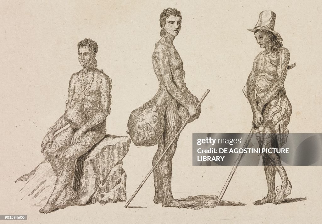 Natives affected by leprosy and elephantiasis