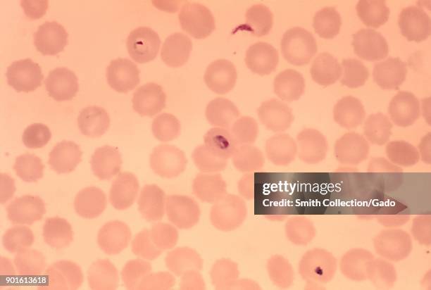 Micrograph image including both growing Plasodium falciparum trophozoite and ring form of the parasite, 1973. Image courtesy CDC/Dr. Mae Melvin.