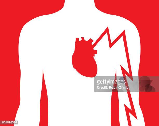 hearts attack left arm pain - robinolimb heart stock illustrations