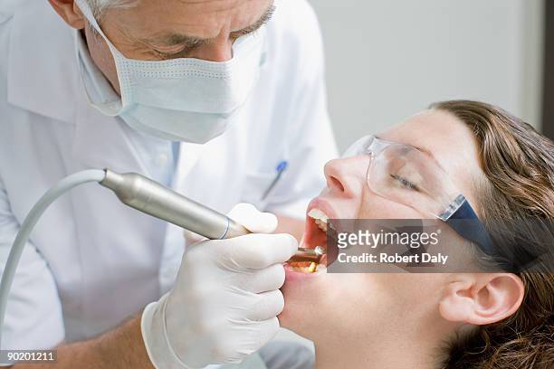dentist working on patients teeth - dental caries stockfoto's en -beelden