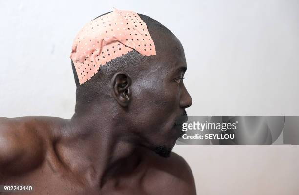 Victim of an attack by armed men in the Bayotte forest waits after being treated in the regional capital Ziguinchor, southern Senegal on January 7,...