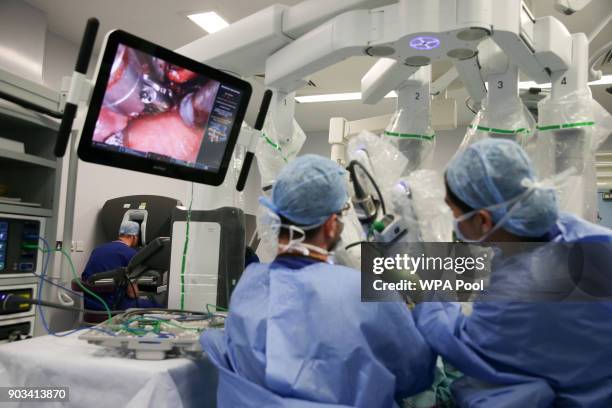 Britain's Prince William, Duke of Cambridge looks through a dual console of the da Vinci robot while lead surgeon Vin Paleri performs a minimally...