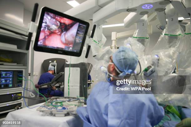 Prince William, Duke of Cambridge looks through a dual console of the da Vinci robot while lead surgeon Vin Paleri performs a minimally invasive...