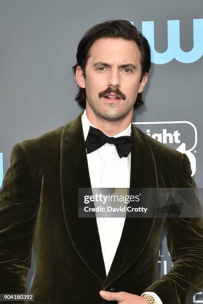 The Story Behind Milo Ventimiglia's Crooked Mouth