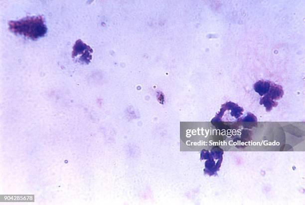 Plasmodium falciparum gametocyte revealed in a blood smear photomicrograph, 1963. Image courtesy Centers for Disease Control /NJ. Wheeler, Jr.