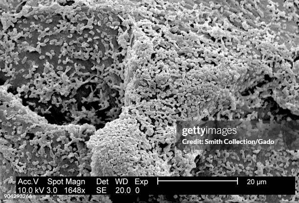 Micrograph of P mirabilis biofilm, colony of the Gram-Negative bacteria grown using a CDC biofilm reactor on a polycarbonate surface, magnified...