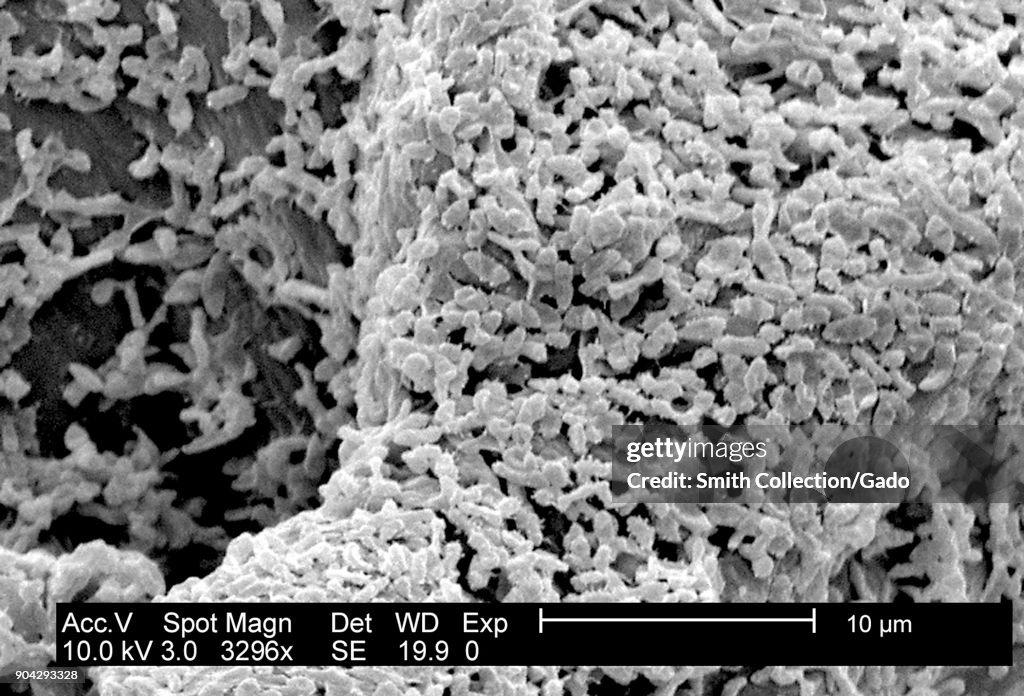 P. Mirabilis Biofilm
