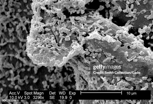 Micrograph of P mirabilis biofilm, a bacterial colony grown on a PC surface using a CDC biofilm reactor, 2003. Image courtesy CDC/CDC, Biofilm...