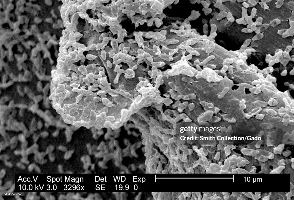 P. Mirabilis Biofilm