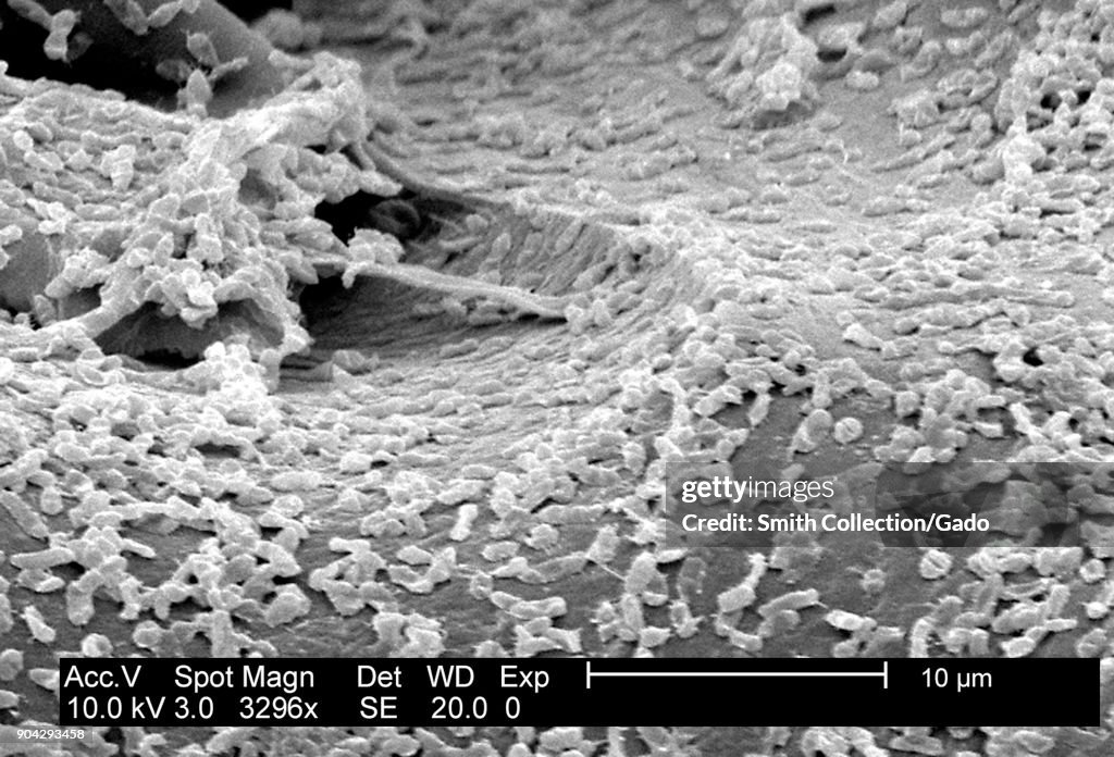 P.Mirabilis (ATCC 29906) Biofilm