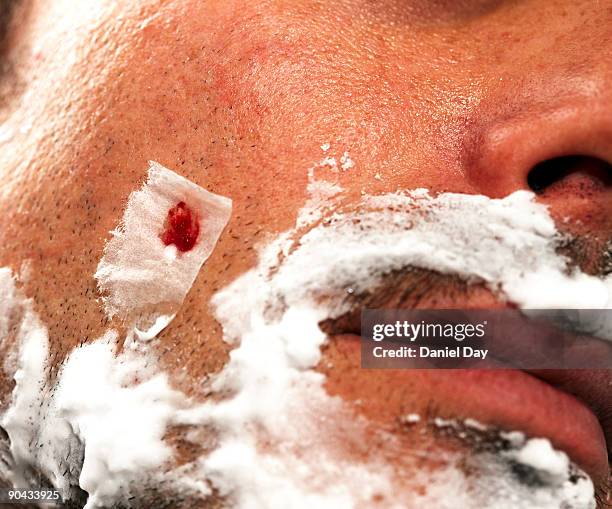 Slashed Bleeding 1,392 Head Injury Bleeding Stock Photos, High-Res Pictures, and Images ...