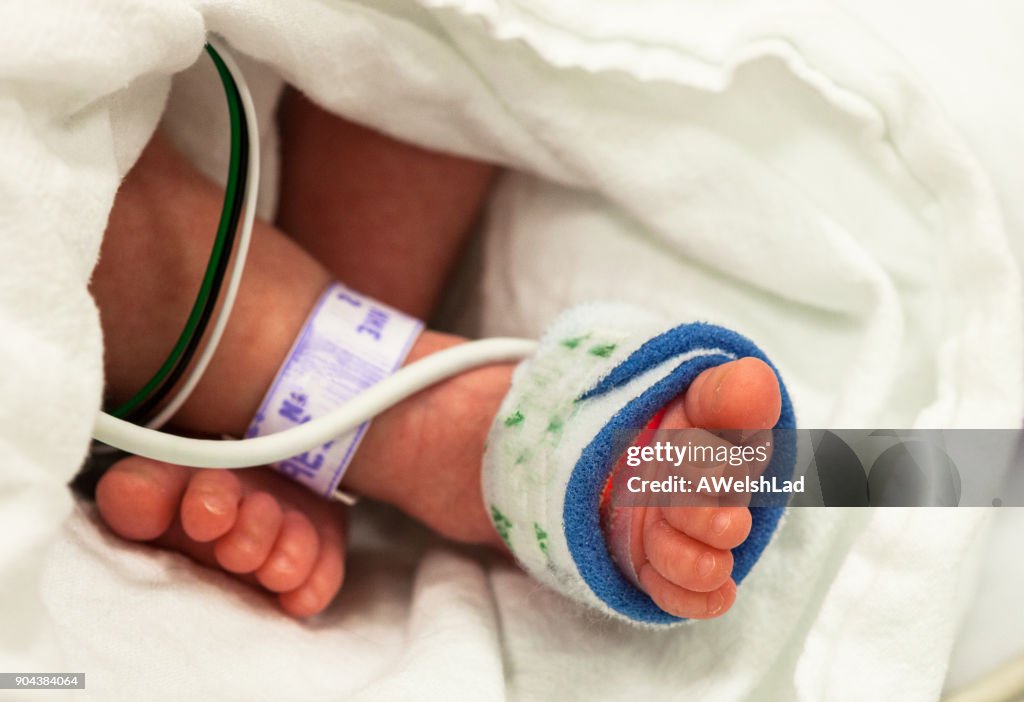 Piede di un bambino prematuro nell'unità di terapia intensiva neonatale