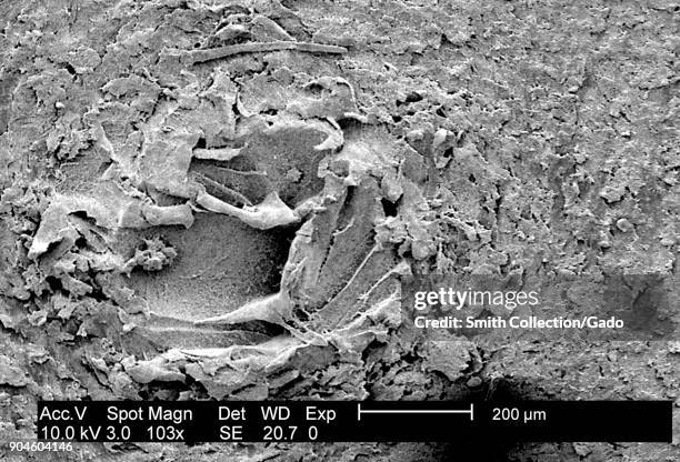 Micrograph of a 24 hour-biofilm of Proteus mirabilis , a Gram-Negative bacterial colony on a polycarbonate coupon, in low magnification , 2003. Image...