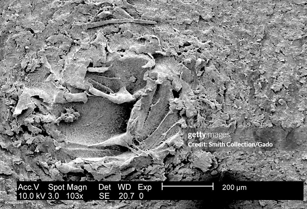 24Hr Biofilm Of P. Mirabilis