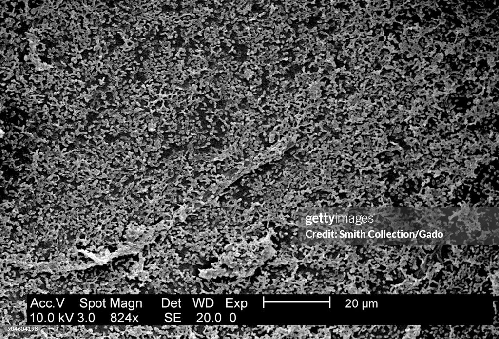 P.Mirabilis (ATCC 29906) Biofilm
