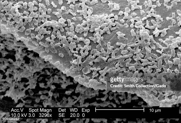 Micrograph of P mirabilis biofilm, a Gram-Negative bacteria colony cultivated using a CDC biofilm reactor on PC coupons, 2003. Image courtesy...