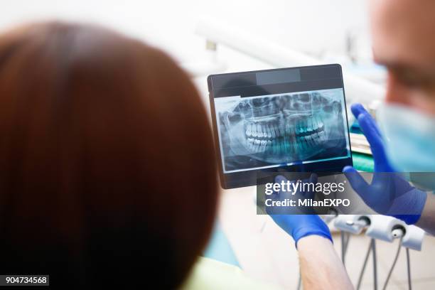 dentist showing a patient her x-ray - dental imaging stock pictures, royalty-free photos & images