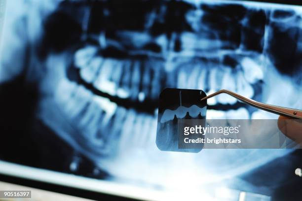 dental x-ray - rotten teeth from not brushing 個照片及圖片檔