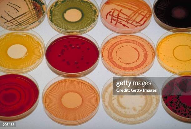 Variety of bacterial cultures grow in petri dishes at pharmaceutical company Aventis Pasteur in this undated file photo. Aventis Pasteur announced...