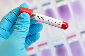 H1N1 influenza virus positive