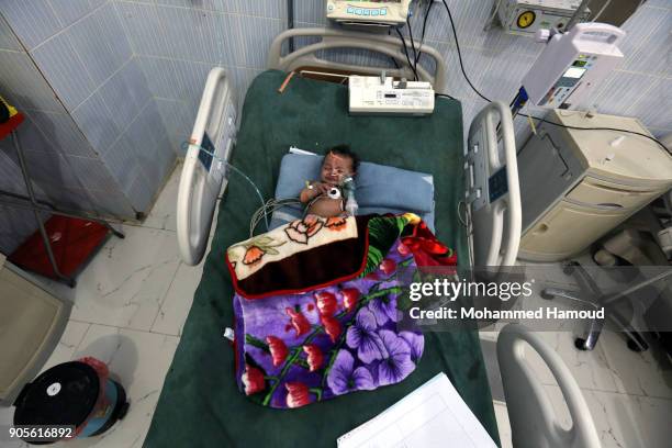 Yemeni malnourished child receives medical treatment at a malnutrition center amid increasing threats of health collapse in war-torn Yemen on January...