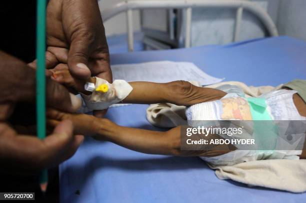 Malnourished Yemeni child receives treatment at a hospital in the Yemeni port city of Hodeidah on January 16, 2018. More than three-quarters of...