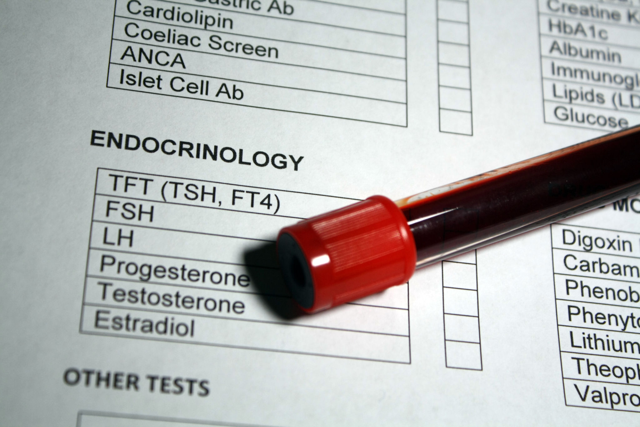 endocrinology consultation