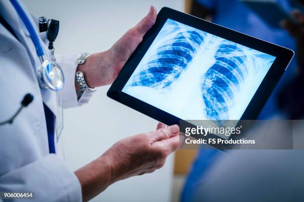 doctors examining x-ray of chest and ribs on digital tablet - röntgen stockfoto's en -beelden