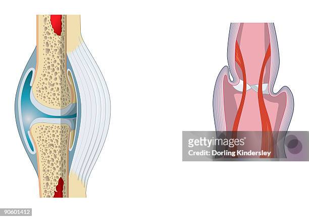digital illustration of invertebrate joint, left, and vertebrate joint, right - 動物の筋肉点のイラスト素材／クリップアート素材／マンガ素材／アイコン素材