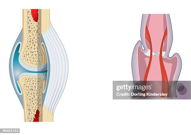 digital illustration of invertebrate joint, left, and vertebrate joint, right - bone marrow stock illustrations