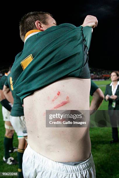 Bakkies Botha displays his injuries after winning the Tri Nations Test between the New Zealand All Blacks and South Africa Springboks at Waikato...