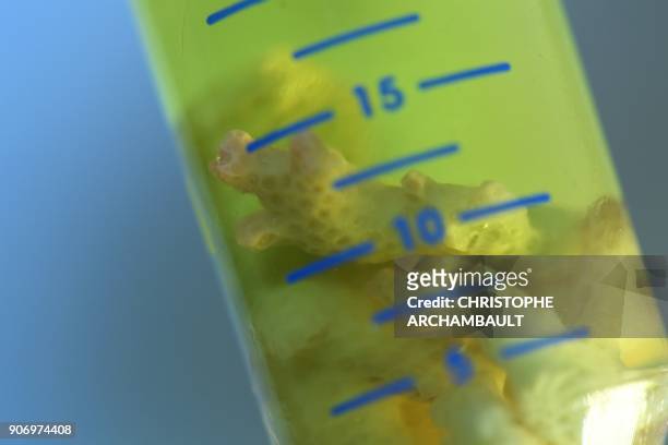 Researcher holds a coral sample in a test tube at the National Sequencing Center in Evry, outside Paris, on November 9, 2017. Far from the atolls of...