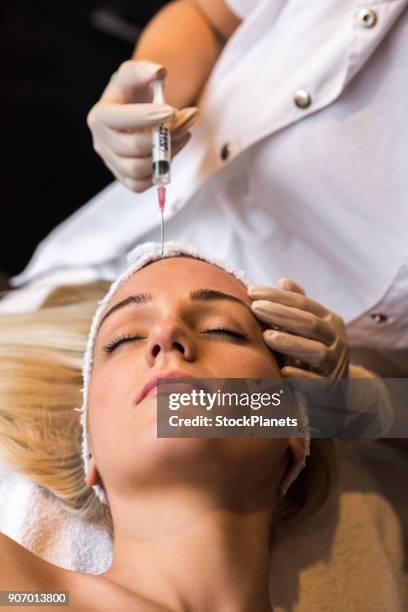 botox therapy - ácido hialurónico imagens e fotografias de stock