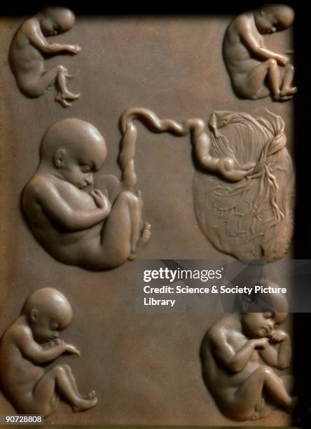 Dissect Embryo 621 Plaque Maker Stock Photos, High-Res Pictures, and Images - Getty Images