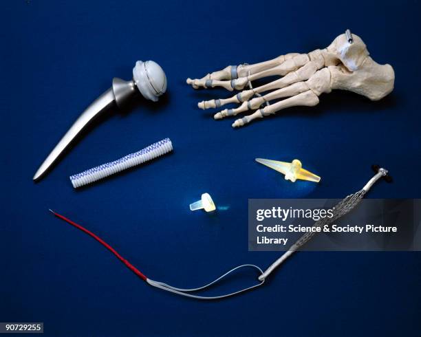 Selection of objects illustrating how synthetic materials can be used in replacement surgery. Clockwise from top left: a stainless steel and ultra...