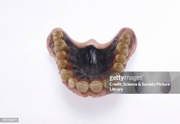 Set of false teeth made from acrylic reinforced with carbon fibre. Carbon fibre is incredibly hard wearing, but as can be seen, it is black which is...