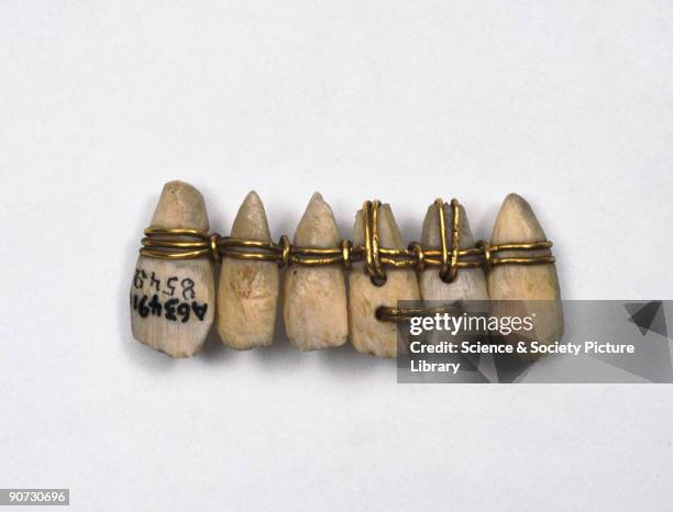Copy of a denture consisting of six ivory teeth bound with gold wire. The original was excavated at Sidon, situated in modern Lebanon, in 1802, and...