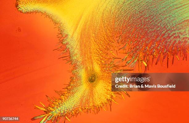 Light micrograph in uncrossed polars. Magnification 50x.