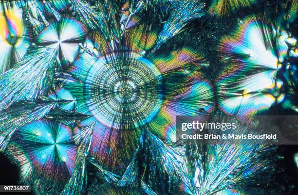 Light micrograph in uncrossed polarised light. Magnification 100x.