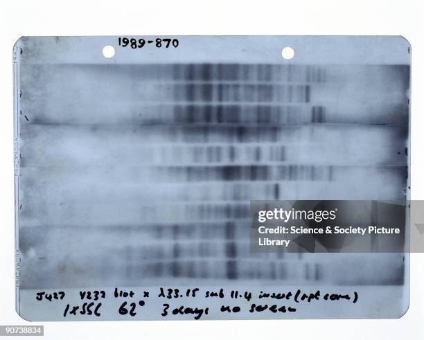 An autoradiograph of the first genetic fingerprint prepared by Alec Jeffreys at Leicester University on 19 September 1984. Jeffreys was the first to...