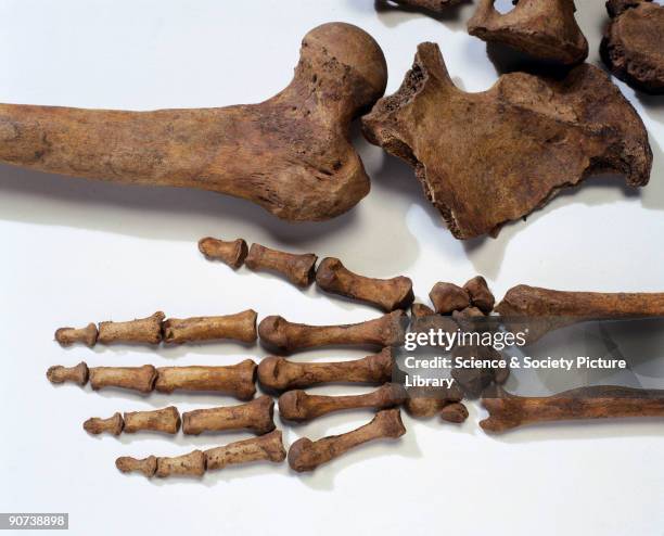 Bleadon Man was one of two skeletons discovered when building began on a new housing estate on Whitegate Farm, Bleadon, Somerset, in 1998. The...