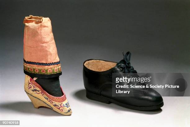 The bound foot is shown with a normal-sized shoe for comparison. Binding women's feet was a painful and crippling Chinese tradition which kept the...