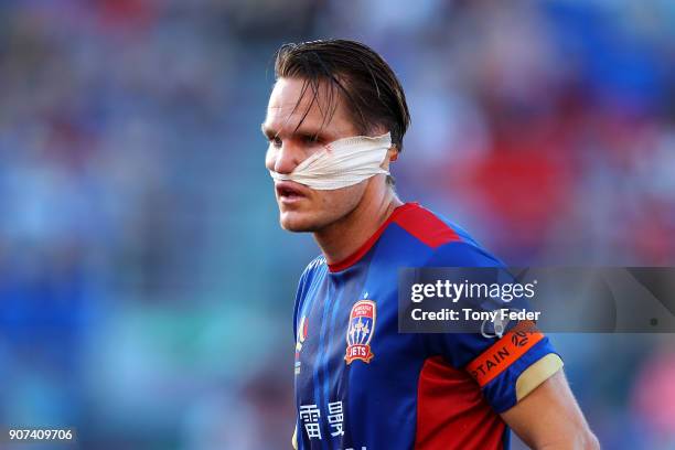 Nigel Boogaard of the Jets after getting injured during the round 17 A-League match between the Newcastle Jets and Wellington Phoenix at McDonald...